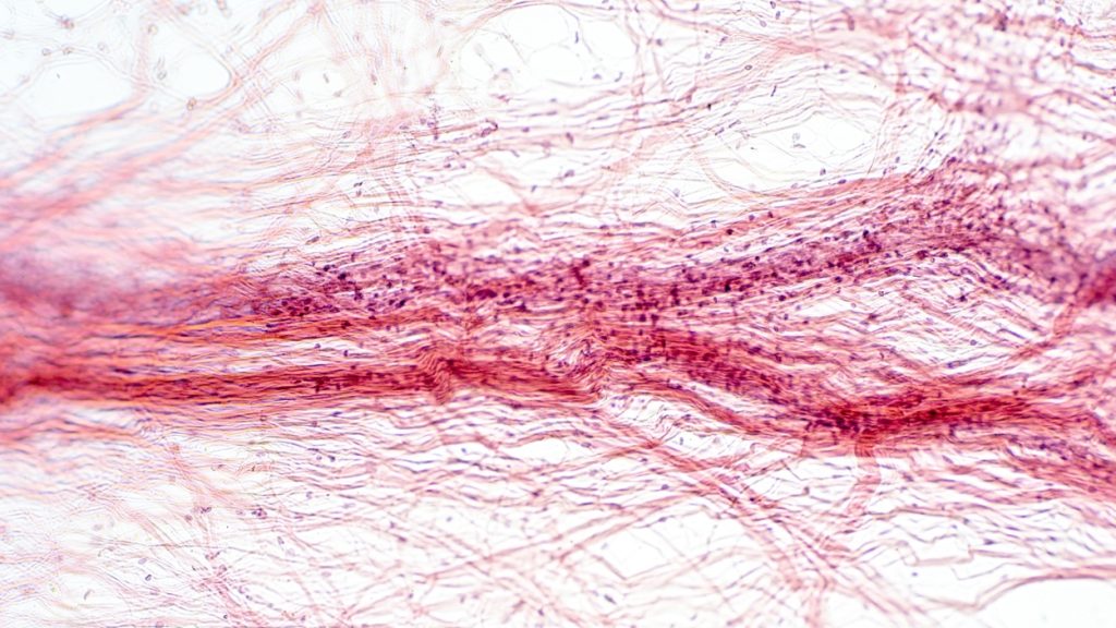 Your CAC Is the Scoreboard. Your Glycocalyx Is the Playing Field.
